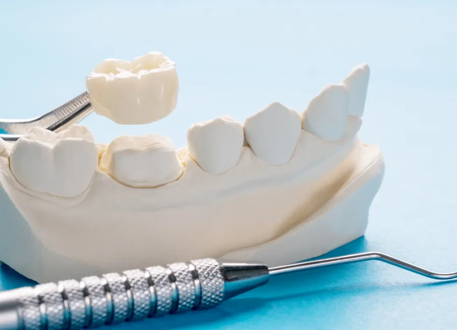 Same Day Dental Crowns at [pracitice_name] in Las Vegas, NM